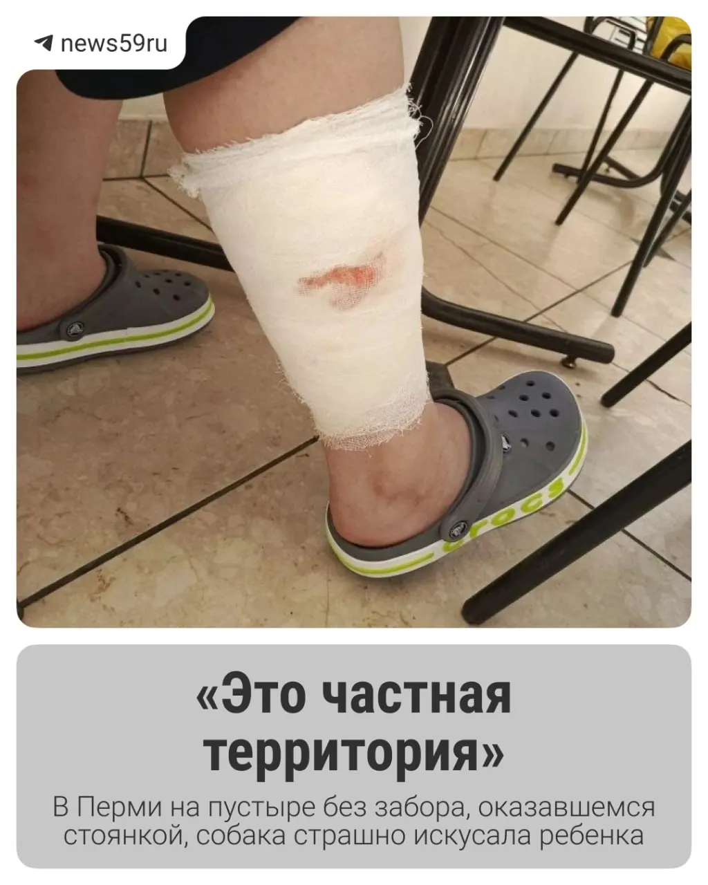 На стоянке у продуктового магазина собака породы овчарка сильно покусала школьника — его госпитализировали в экстренную хирургию, полиция начала проверку.