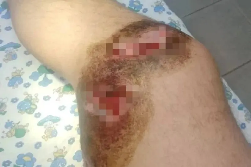 Мужчину, пришедшего на рыбалку, напали три собаки на территории со шлагбаумом; пострадавший ждал помощи почти два часа, уголовное дело не возбуждено.