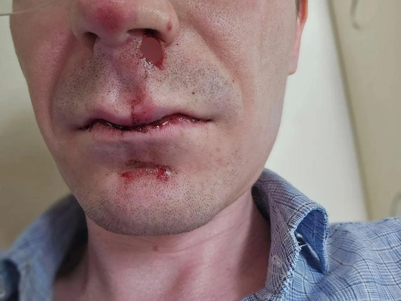 Утром 14 июня на перекрёстке Революции и Островского пятеро–семеро подростков напали на двоих мужчин. Одного из подозреваемых направили в центр временного содержания, по факту нападения возбуждено уголовное дело, законным представителям подростков выписаны протоколы.