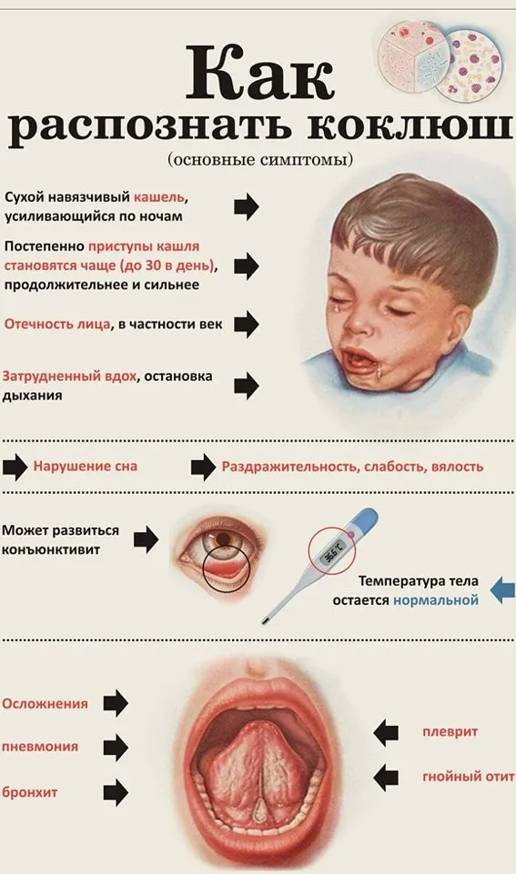Региональные врачи бьют тревогу: в 2023 году в области зафиксировали вспышку коклюша, в последующие годы число случаев уменьшилось, но в начале 2026-го зарегистрированы новые заражения, в основном среди детей. Медики напоминают о важности прививок.