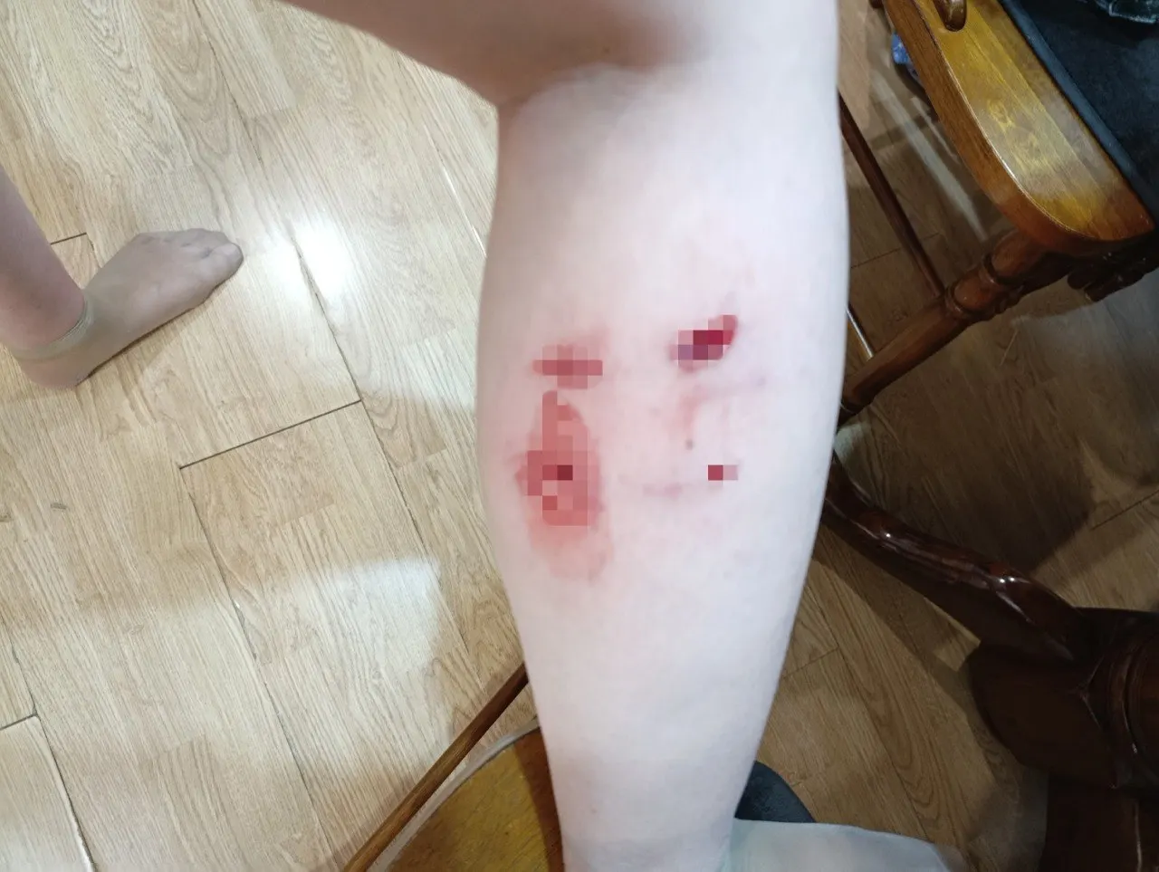 В Уфе женщина получила рваные и глубокие раны после нападения трёх крупных собак во дворе на улице Адмирала Ушакова. Отлов не обнаружил животных на следующий день.