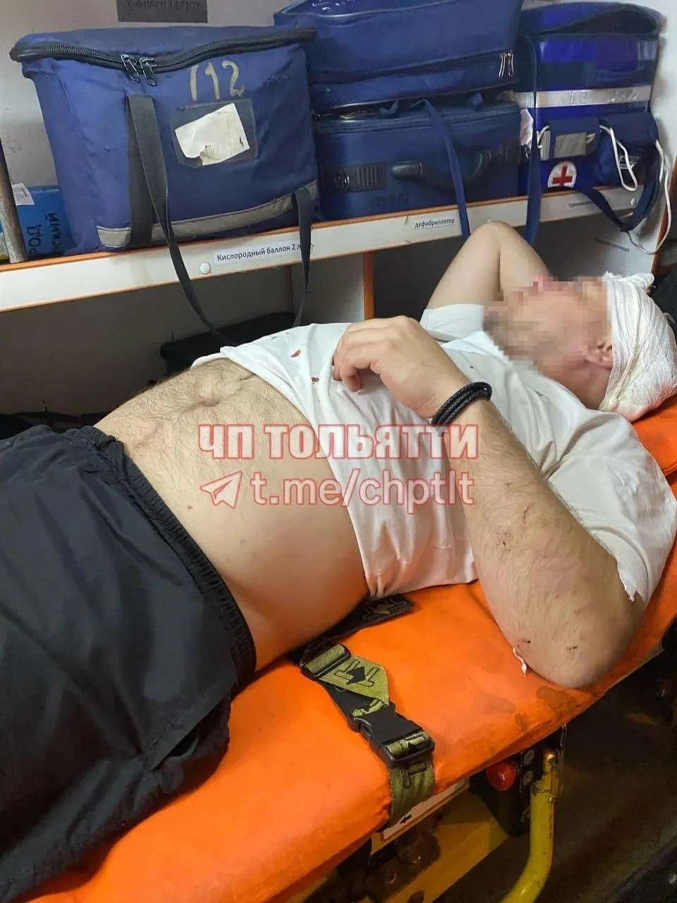 В&nbsp;Тольятти на&nbsp;пешеходном переходе избили мужчину&nbsp;— проломили голову
